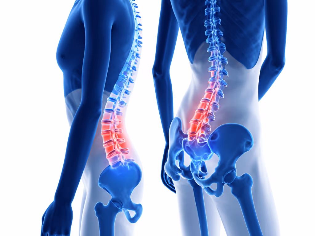 spinal_disc_pressure_metrics